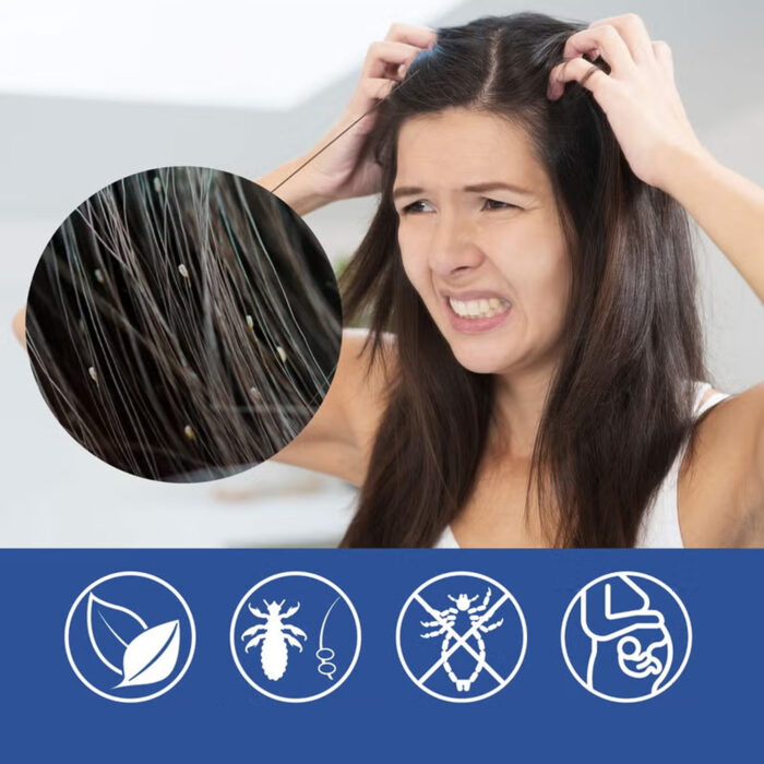⁦مشط إزالة القمل الكهربائي+بخاخ علاج فعال للقمل امن للاطفال والكبار⁩ - الصورة ⁦3⁩