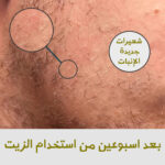 ⁦سر اللحية الجذابة – ماكينة تحديد + زيت التحفيز هدية⁩ - الصورة ⁦8⁩