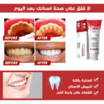 ⁦SP6 - المعجون الأسرع و الأقوى لتبييض الأسنان⁩ - الصورة ⁦3⁩