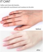 ⁦زيت تقشير الجلد الميت السحري⁩ - الصورة ⁦7⁩