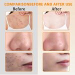 ⁦• صابون حمض الكوجيك الكوري⁩ - الصورة ⁦4⁩