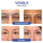 ⁦كريم التخلص من تجاعيد منطقة العين⁩ - الصورة ⁦3⁩